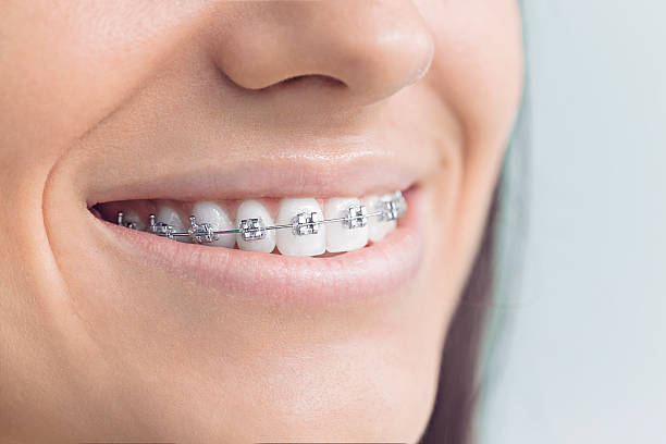 Best Full Mouth Reconstruction  in Pine Ridge, SC